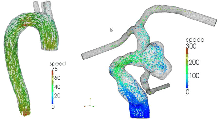 Patient-specific blood flow simulation
